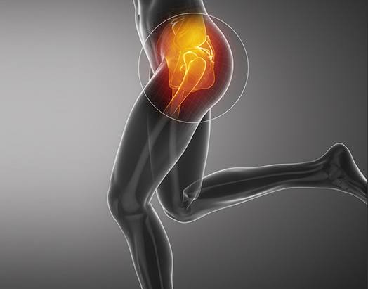 Hip Service at Benjamin Young, M.D. Orthopedic Surgeon Adult Hip & Knee Joint Reconstruction